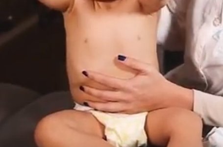 Tratamento de clicas atravs de tcnicas miofasciais (Osteopatia Peditrica) com Sofia Milhano